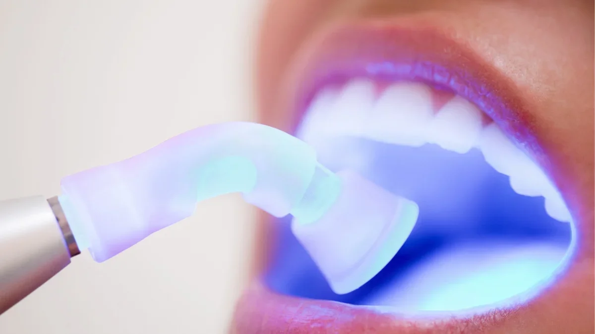 Dental Bonding