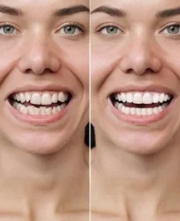 Woman smiling after orthodontic treatment