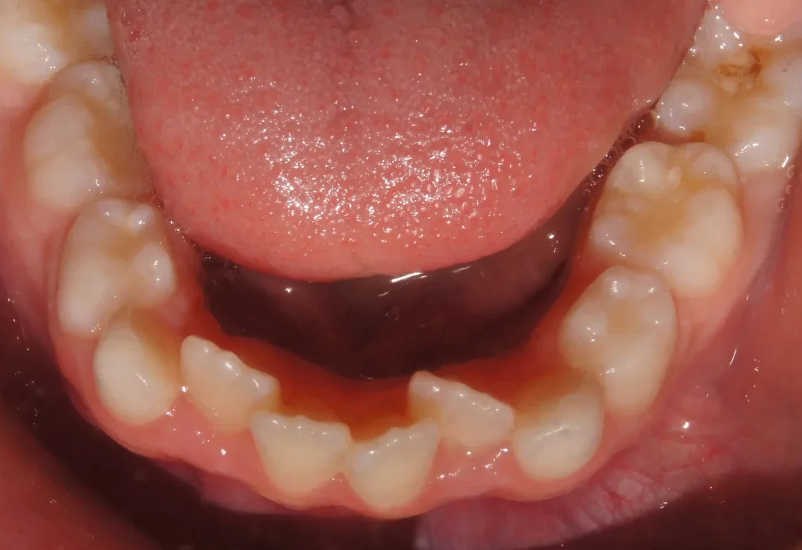 Man with straightened teeth