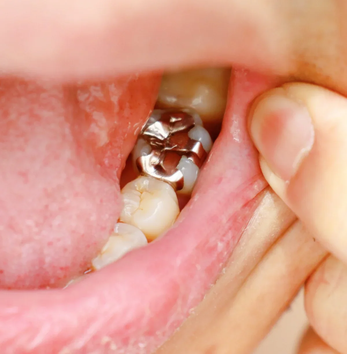 Vitality Health emergency dental clinic