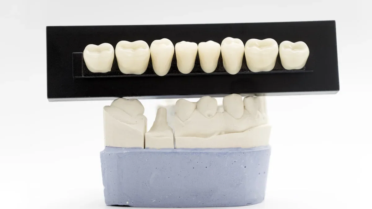 Natural-looking dental restoration