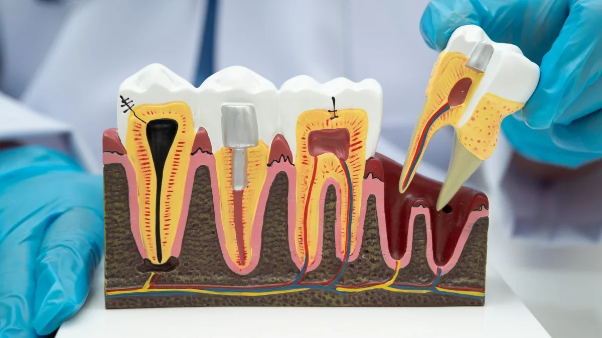 Restored smile with restorative dentistry